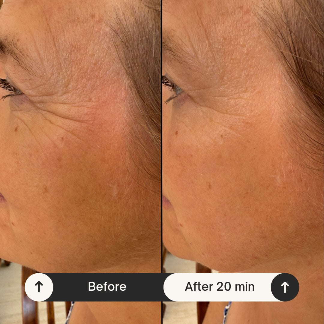 Before and after